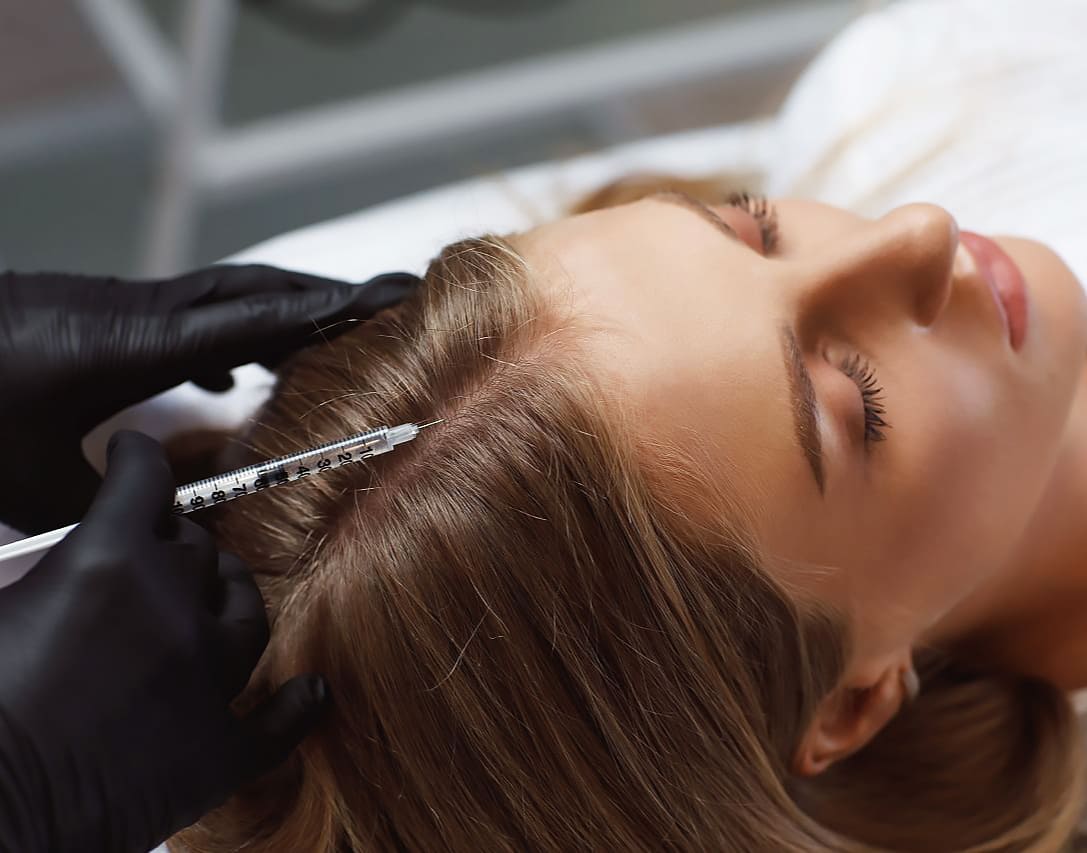 Мезотерапия волос – революционный подход к здоровью волос