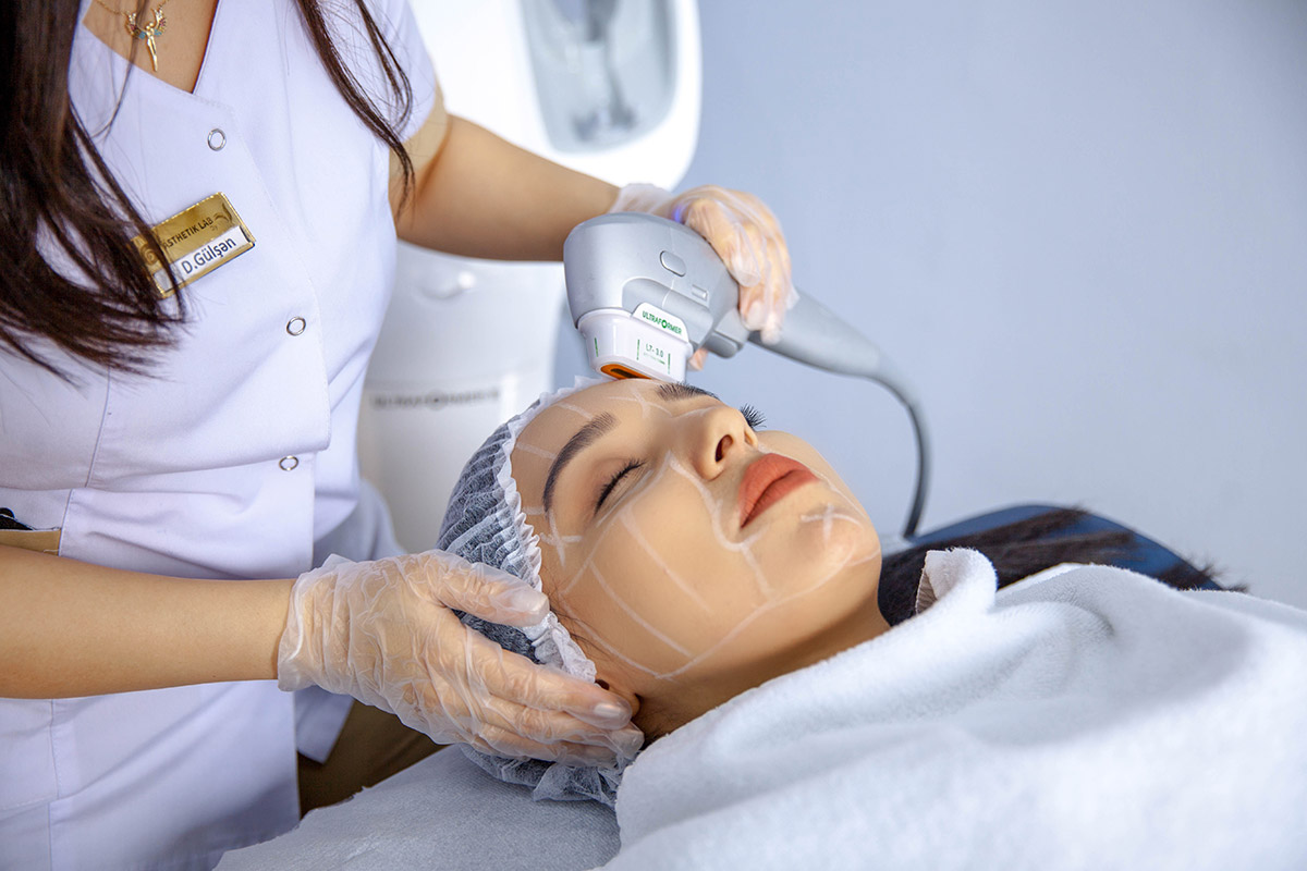 AZ – radiofrequency lifting2