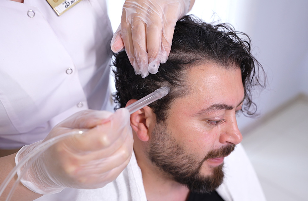 Лечение себореи